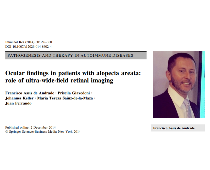 Ocular findings in patients with alopecia areata: role of ultra-wide-field retinal imaging
